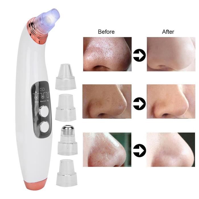 Nettoyeur De Pores électrique USB - Pour Points Noirs Et Acné - SODIAL Neuf