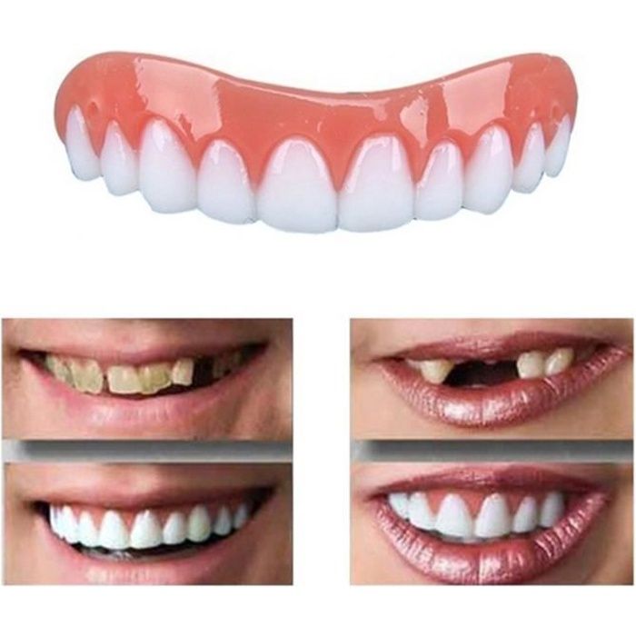 Pour la correction des facettes des dents Perfect Smile
