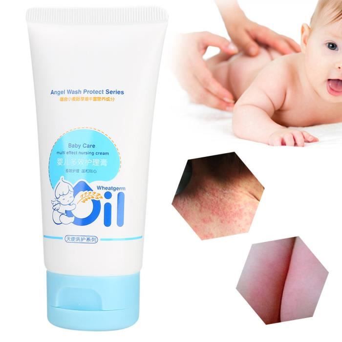 Qiilu Creme Pour Erytheme Fessier Pour Bebe Pommade Erytheme Fessier Multi Effets Bebe Creme Corps Naturelle Protectrice Cdiscount Au Quotidien