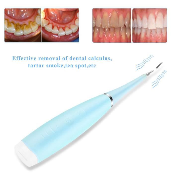 Nakeshop Detartreur Dentaire Outil De Retrait Du Tartre Des Dents Achat Vente Nettoyant Appareil Dent Nakeshop Detartreur Dentair Cdiscount