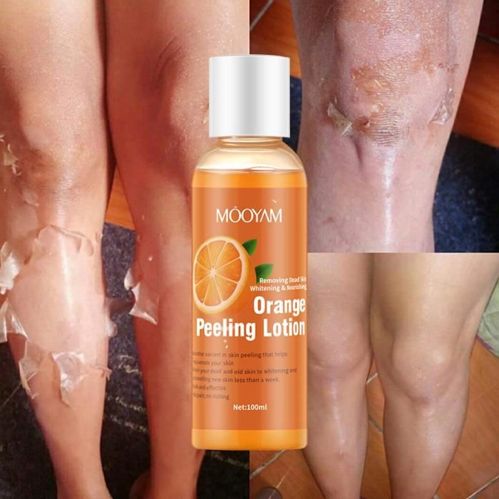 Huile De Peeling Exfoliante Pour Peaux Mates Et Foncées - Effet éclat - Produit Neuf