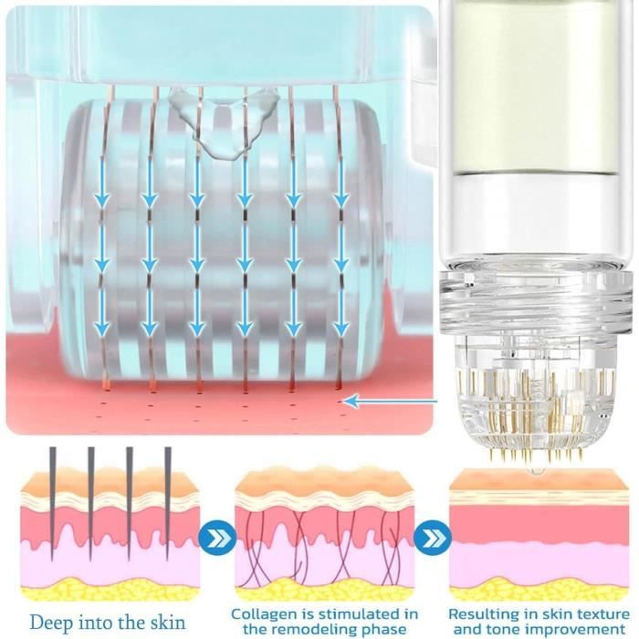 elfbar nachfll pod luft aus Injection de remplissage dermique  l'acide hyaluronique Bonetta Meilleures  ventes 2*1.1ml