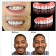 1pc Silicone Hommes Femmes Perfect Smile Placage Denture Paste Instant Dents Flex-2