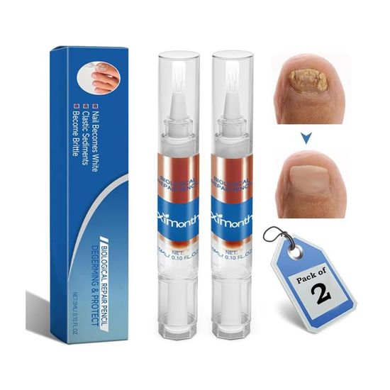 Traitement Puissant Contre La Mycose Des Ongles Des Pieds - 10ml En Gouttes - Marron