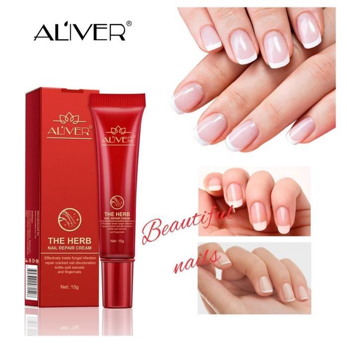 Uyiogoo La Creme Reparatrice Pour Les Ongles Exfolie Protege Et Repare L Onychomycose Des Ongles Uyi0 Achat Vente Creme Change Bebe Soldes Sur Cdiscount Des Le Janvier Cdiscount Uyiogoo La Creme Reparatrice Pour Les Ongles Exfolie Protege Et Repare L Onychomycose Des Ongles Uyi0 Achat Vente Creme Change Bebe Soldes Sur Cdiscount Des Le Janvier Cdiscount