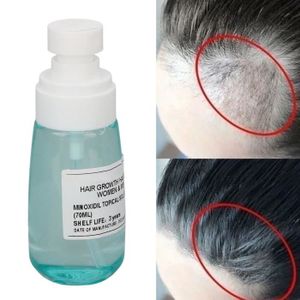 ANTI-CHUTE CHEVEUX ESTINK Spray pour la croissance des cheveux Minoxi
