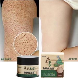 SOIN SPÉCIFIQUE Crème réparatrice à base de plantes du Yunnan jetable pour la peau, Hydratante, élimine les pores optiques, T