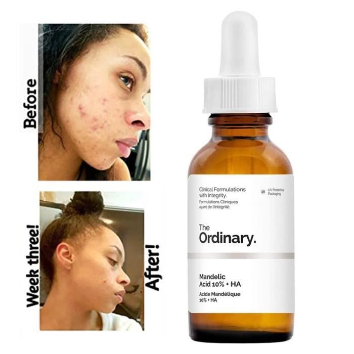 The Ordinary Acide mandélique 10 + Ha Solution Essence acide de peau sujette aux imperfections