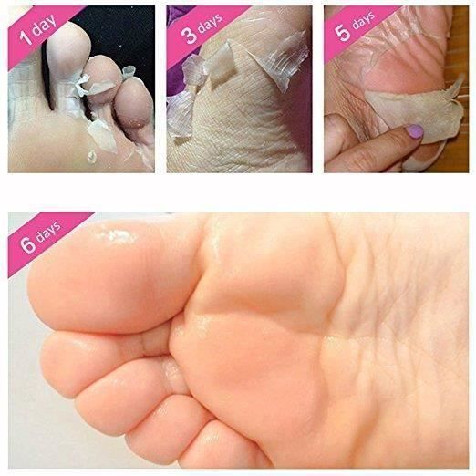 L1497 Pas acide salicylique nourri exfoliant pied masque talon pieds soin Peeling cuticules blanchissant callosités dur mort santé