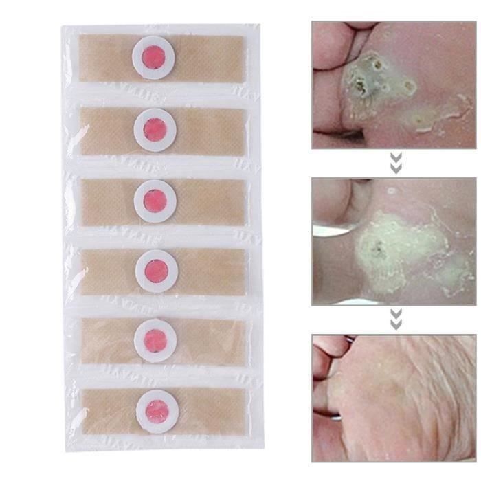 L896 Pied Orteil Maïs Patchs Detox Callosités Épine Autocollant Plâtre Cors Kit