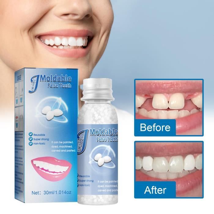 Colle à dents en plastique 30ml modification de prothèse dentaire