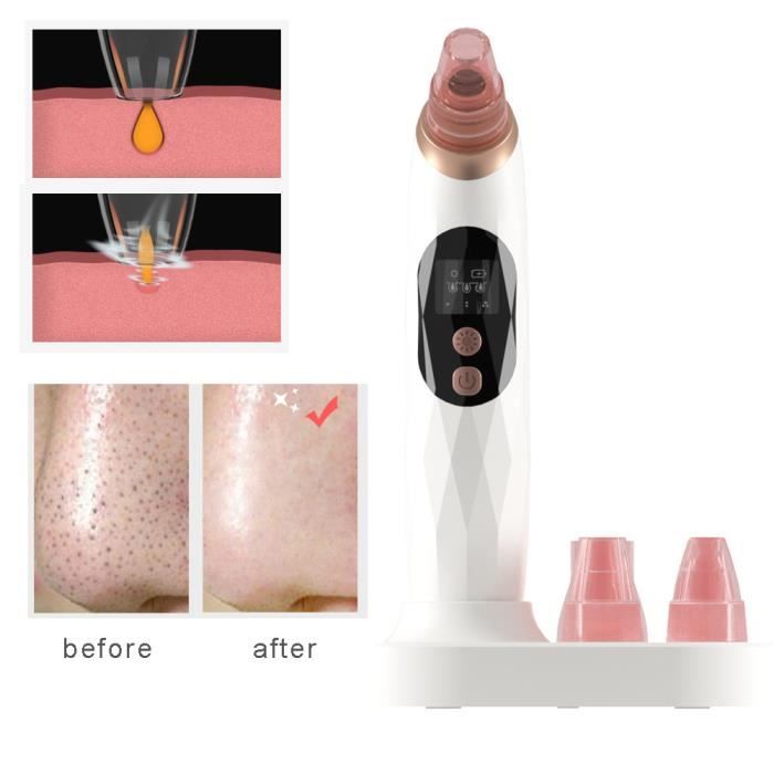 Microdermabrasion vide portable peau amélioration beauté appareil avec écran Digital LCD