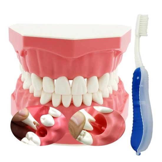 Drfeify Modèle de dents Modèle de Dent Dentaire Enseignement par  Démonstration Orale Adultes Outil de Dentiste avec Brosse