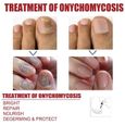 Traitement Mycose Ongles Des Pieds - AUTREMENT - 50ML - Réduit la décoloration et hydrate les ongles cassants-2