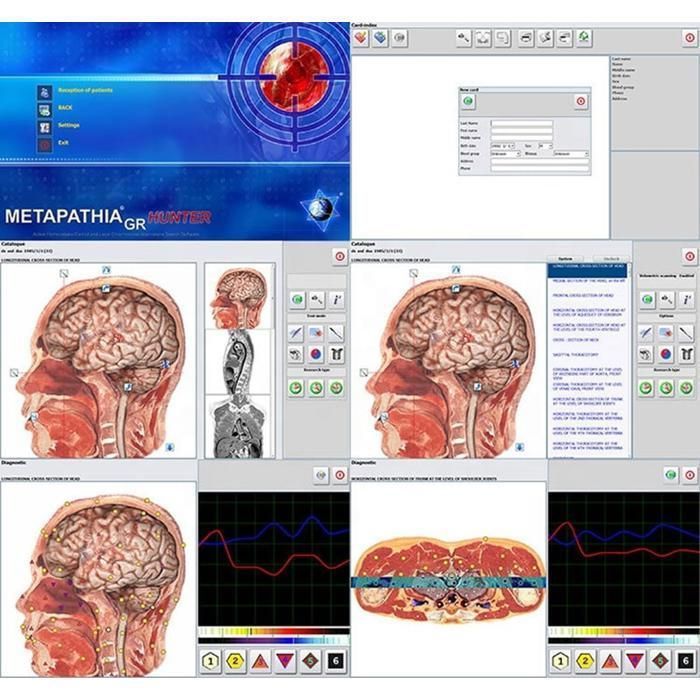 Scanner Metatron Scanner de biorésonance Metatron Hunter 4025 NLS, version 2026 ...