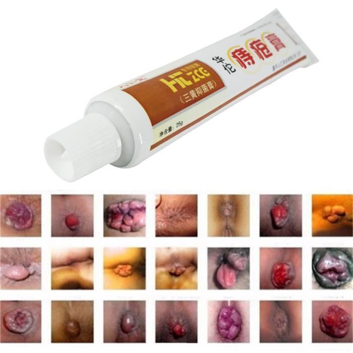 Soins De Sante De Creme De Pommade De Traitement D Hemorroides De Soulagement De Douleur Saignement Puissant Cdiscount