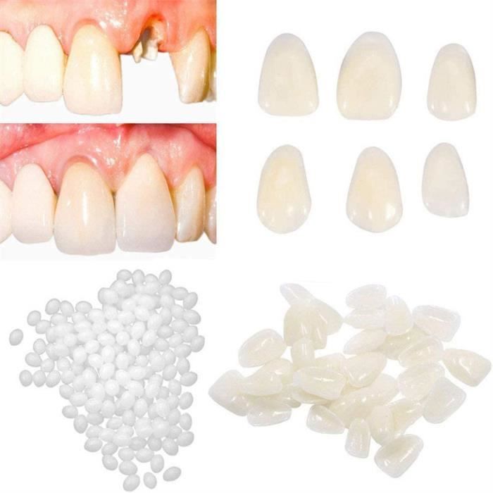 Couronne temporaire, fausses dents, 50 pièces/boîte pour les soins  bucco-dentaires(Front teeth) - Cdiscount Au quotidien