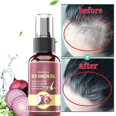 Huile Essence Pour Croissance Rapide Des Cheveux - Anti-Chute, Calvitie, Alopécie - 10 Ml