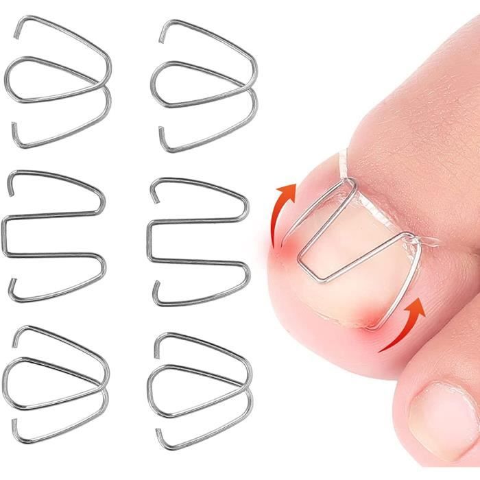 Pinces À Ongles - Outils Incarnés Correcteur D oignons Soins Pieds Pédicure D ongles - Blanc