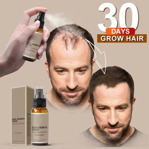 ANTI-CHUTE CHEVEUX Drfeify Spray de soin capillaire anti-chute Spray pour la croissance des cheveux, 30ml, traitement parfum traitement Comme montré
