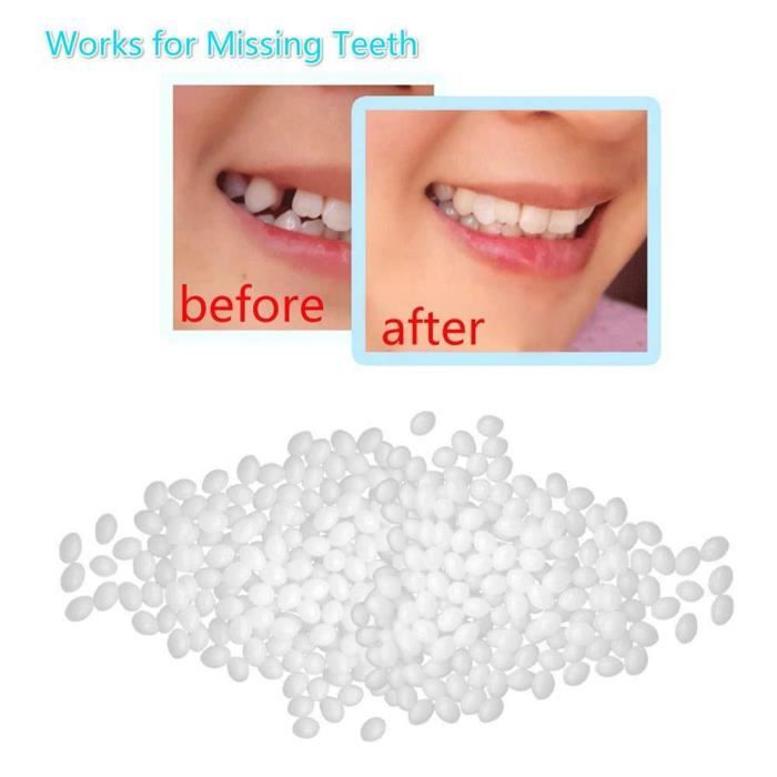 Kit De Reparation De Dents De Colle Solide De Restauration Temporaire De Prothese Dentaire Outil De Soin Oral Achat Vente Soin Blanchiment Dents Nouveaux Produits De Bonne Cdiscount