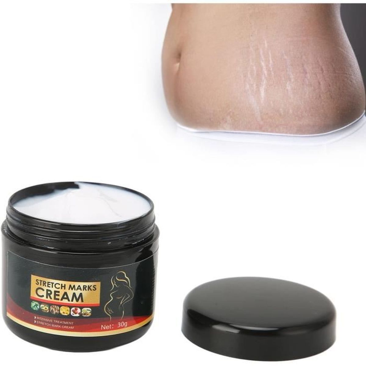 Crème Anti-vergetures Triple Action - 100 Ml, 1 Acheté = 1 Offert, Fabriquée En France