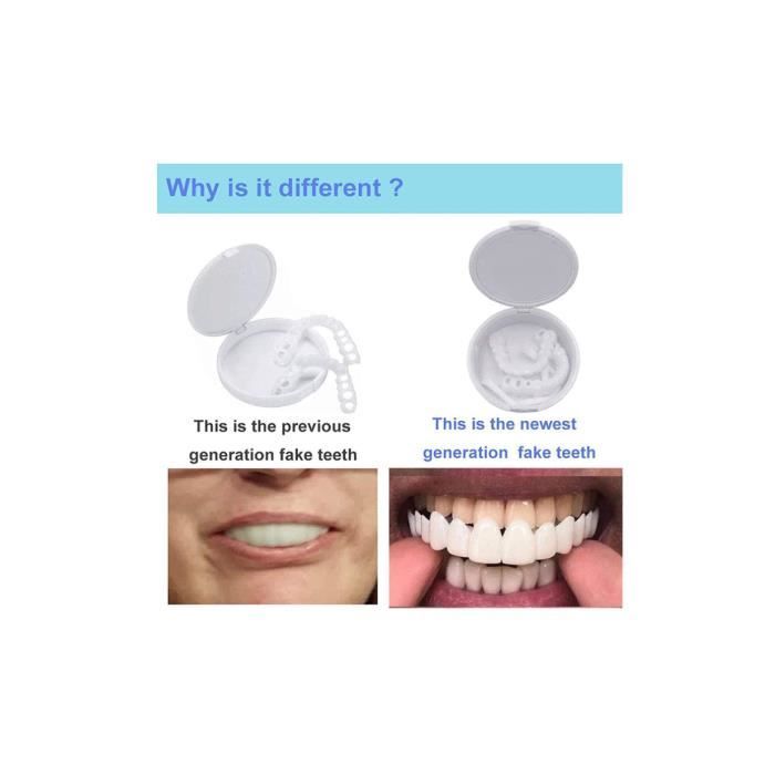 2 paires de fausses dents facettes, facettes dents cosmétiques couvre-dents  fausses dents prothèses temporaires dents dents artificielles