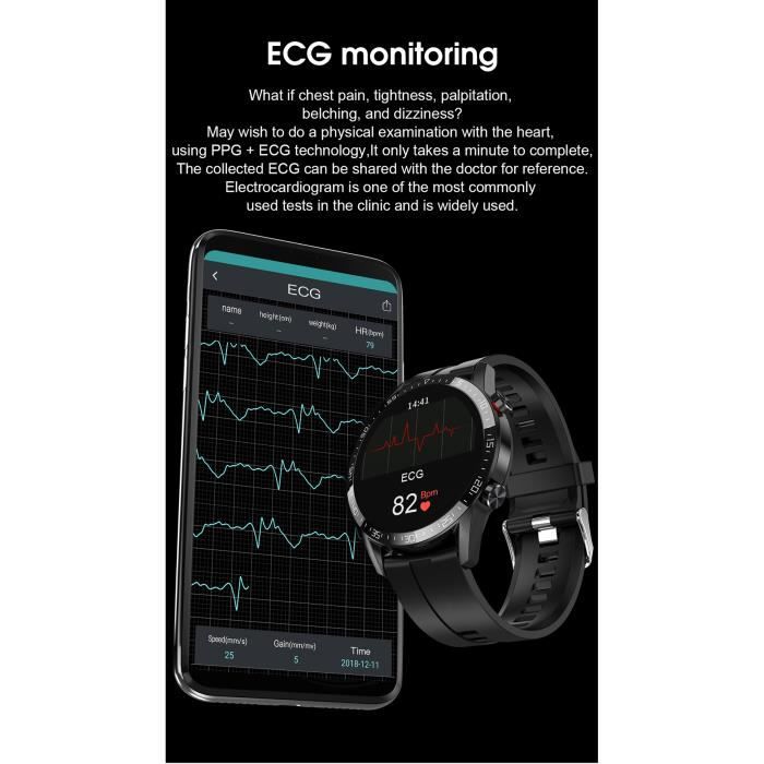 Montre hot sale electrocardiogramme xiaomi