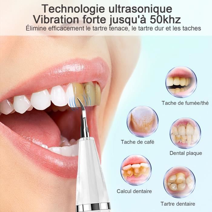VGEBY Nettoyeur de prothèse dentaire Machine de nettoyage ultrasonique de  protège-dents de dispositif de retenue de dentier - Cdiscount Au quotidien