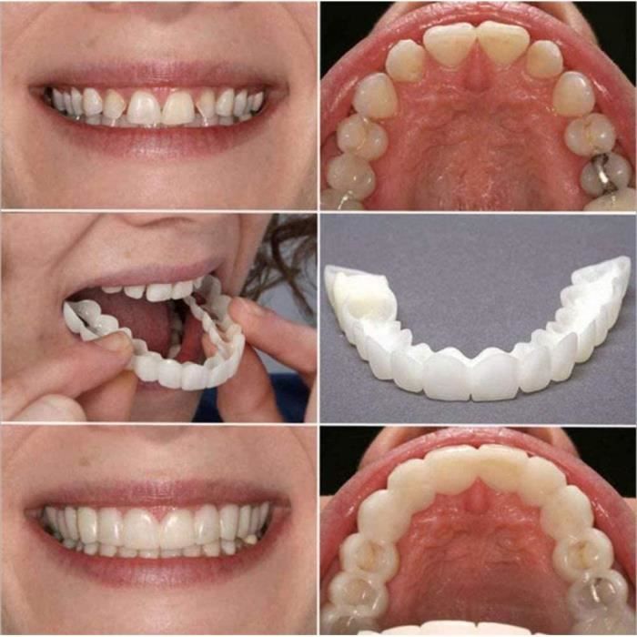 Ulat 4 PCS2 Set Silicone Dentier Haut et Bas Sourire Parfait pour Homme et Femme Amovible Naturel Fausse Dents Provisoire Fa[7278]