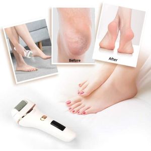 Ponceuse électrique Pour Pieds – Rechargeable, Anti-callosités, Avec Rasoir