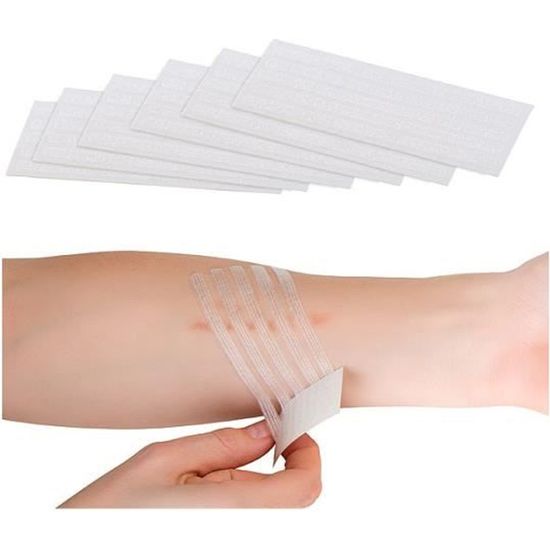 Pack de 30 bandes de suture rapide - NEWGEN MEDICALS - 102 x 6 mm - Réduit les cicatrices visibles