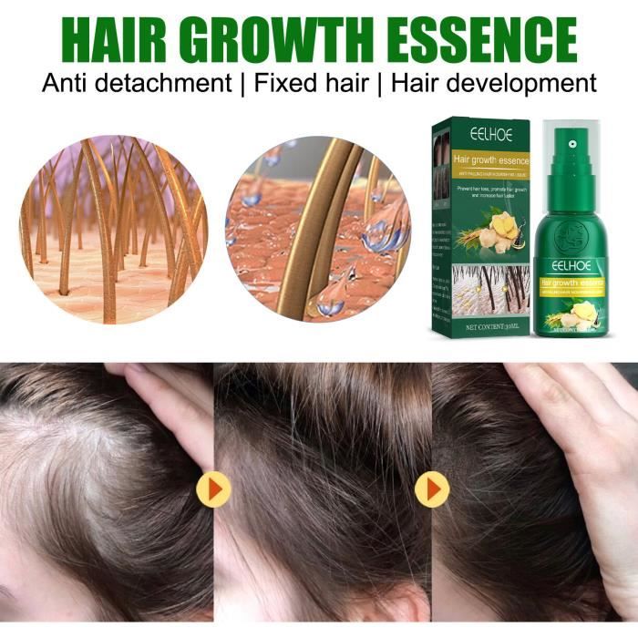Sérum anti chute de cheveux naturel, Croissance des cheveux, Prévention de  la calvitie, Traitement, Pousse ra