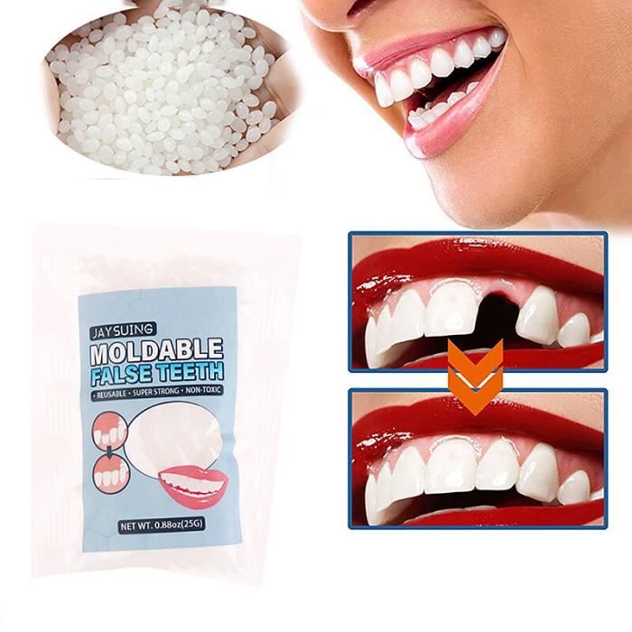Kit de réparation temporaire des dents en résine,fausses dents,colle — free download