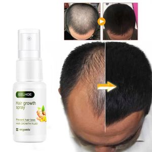 3pcs / 2pcs / 1pcs Gingembre Huile Germinale Cheveux Nutriment Solution De  Croissance des Cheveux Essence Liquide Rapide Cheveux Naturel Traitement de  Perte de Cheveux Soins capillaires