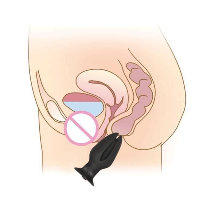 Progrs-L Plug 2 - Plug Anal Vaginal impulsion lectrique masturbateur gode vibrateur lectrostimulation de la - Cdiscount Boutique Erotique Progrs-L Plug 2 - Plug Anal Vaginal impulsion lectrique masturbateur gode vibrateur lectrostimulation de la - Cdiscount Boutique Erotique