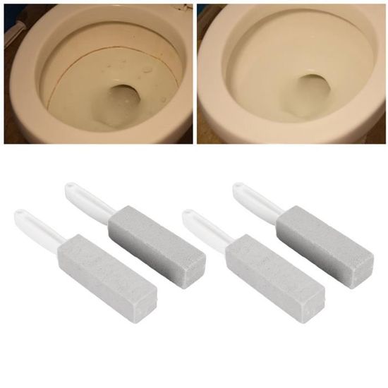 Pierre Ponce Avec Manche Pour Toilettes – Nettoyage Anticalcaire Et Antirouille, Pour Salle De Bain, Cuisine