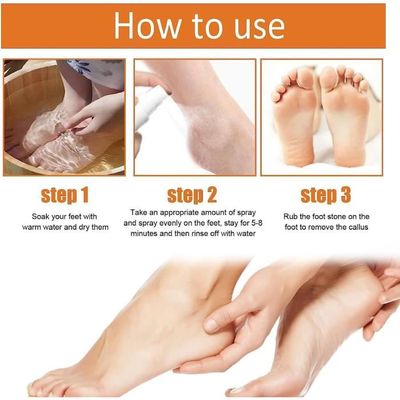 https://www.cdiscount.com/pdt2/8/4/7/4/400x400/auc1689581276847/rw/gfouk-foot-callus-removal-spray-feet-instant-foot.jpg