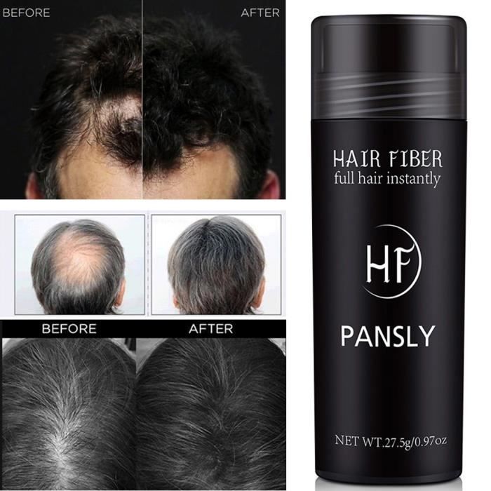 Poudre Densifiante Pour Cheveux TOP**K - Noir - À Base De Kératine - 27,5 Grammes