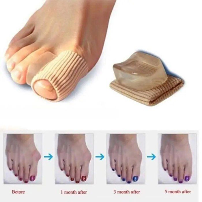 AWAVM Ensemble 3 Pièces De Correction Hallux Valgus Avec Correcteur Hallux Valgus Chaussettes