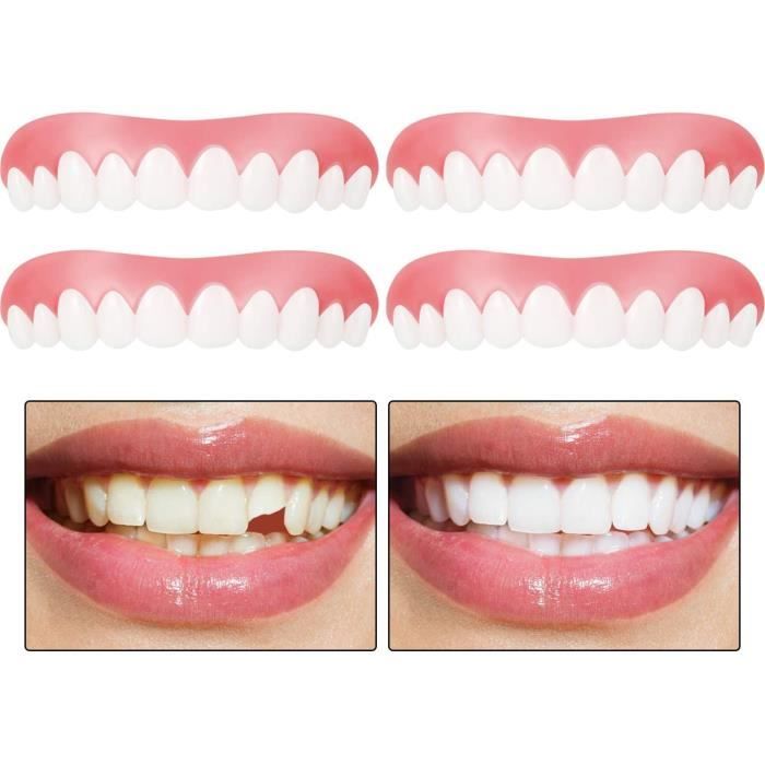 Kits Dentaires Facettes Dentiers Instantanees Dentier Dents Couvrant Manquant Dent Temporaire Kit De Remplissage De Dent 434770 Achat Vente Brosse A Dents Elec Cdiscount