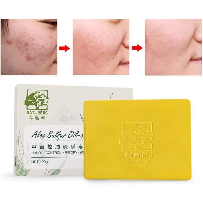 NETTOYAGE DU VISAGE Aloegraves Controcircle de lhuile Savon au Soufre KISSION Savon 100 Naturel au Soufre Pour le Psoriasis Acn1853