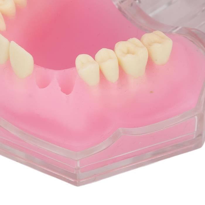 ELEGANCE ESTELLE Protège-dents, appareil dentaire, Soins Dentaires  Orthodontiques - Cdiscount Au quotidien