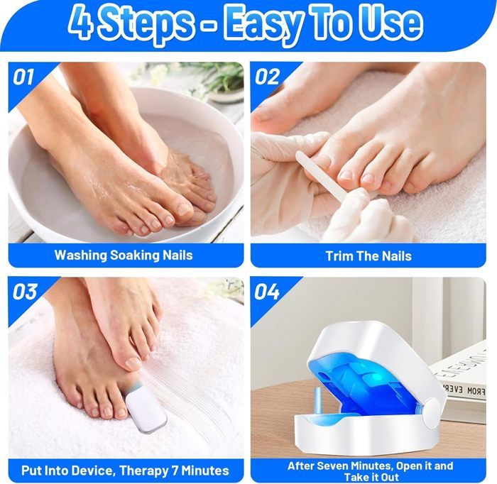 Appareil électrique Anti-mycose Ongles Mains/pieds Mycocare - Manucure Pédicure Silencieux Neuf
