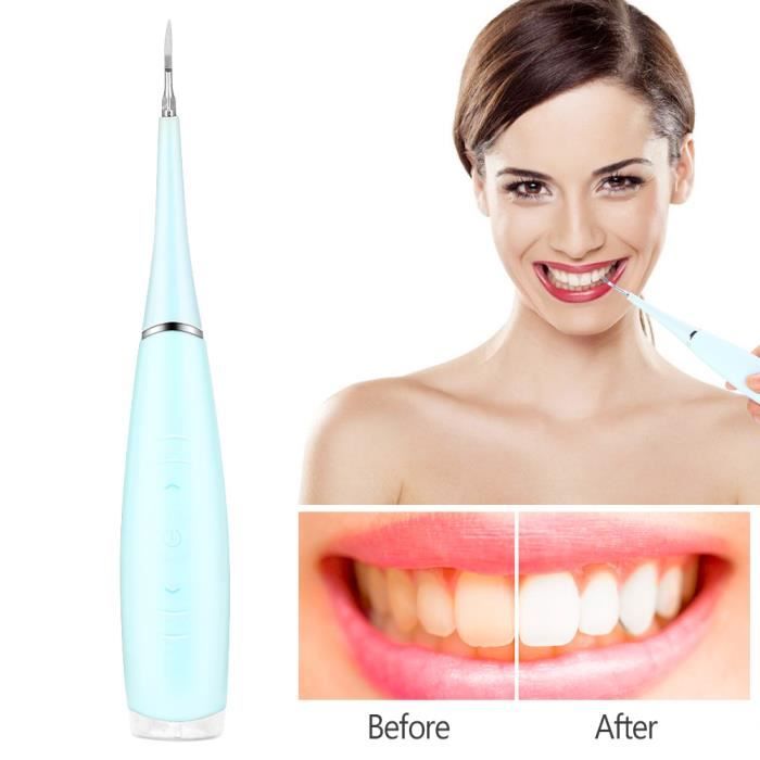 Détartreur dentaire domestique portable Détartreur dentaire Dissolvant de tartre dentaire Dental Care_blue