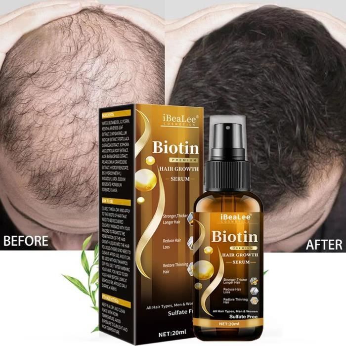 Complément Alimentaire Anti-chute DHT Blocker - Croissance Cheveux & Barbe, 100% Naturel
