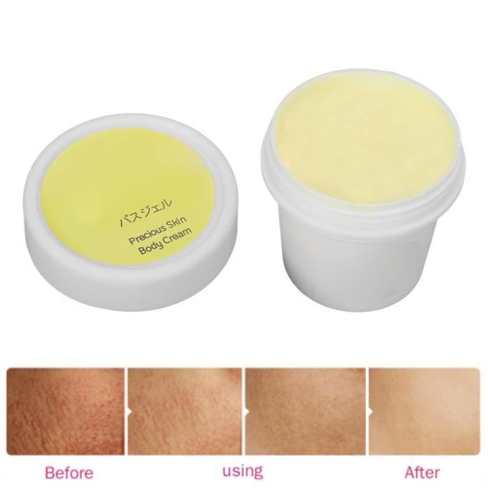 Crème Vergetures Raffermissante – Base Plantes & Acide Hyaluronique – 40g – Fabriqué En France