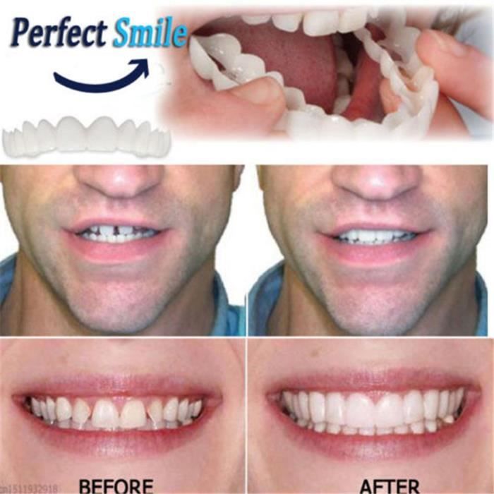 Tooth Instant Perfect Smile Flex Blanchiment des dents Sourire Faux Outil Couvre Dents
