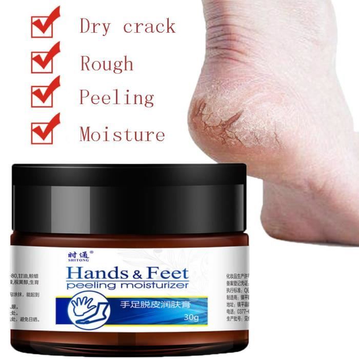 Crème hydratante pour les mains et les pieds pour éviter les craquelures de la peau du talon des pieds ZCT80808082_Nfanniake
