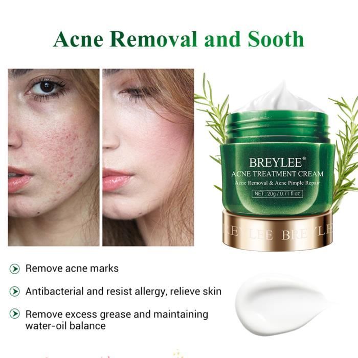 Acne treatment online essence cream